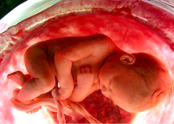 Quince mujeres embarazadas, entre la semana 20 y 34 de gestación a las que se les diagnostique esta malformación, se someterán a una terapia que consistirá en introducir células madre a través de su útero