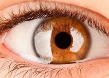 Es de suma importancia cuidar la salud ocular en las diferentes etapas de la vida.