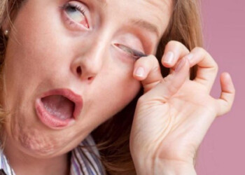 Existen cinco (5) tipos diferentes de alergia ocular que deben ser tratados