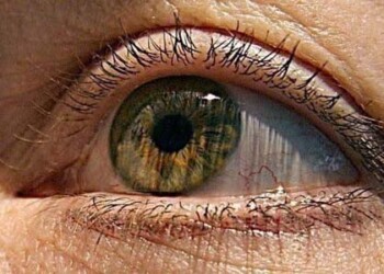 El glaucoma se corresponde con la primera causa de ceguera irreversible en todo el mundo.