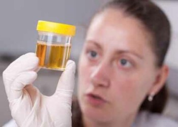 El color de nuestra orina puede ser de lo más elocuente si lo que estamos buscando es analizar nuestro estado de salud.