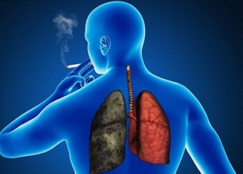 La exposición al humo del cigarrillo sigue siendo la principal causante de este mal