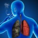 La exposición al humo del cigarrillo sigue siendo la principal causante de este mal