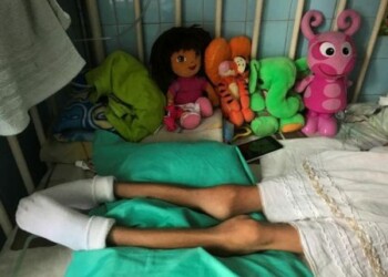 Al menos 16 % de los niños venezolanos sufrió de desnutrición en 2017, según ONG