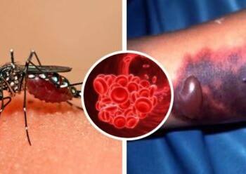 Una muerte por dengue hemorragico enciende alarmas en El Paso