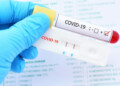 Positive test result by using rapid test device for COVID-19 virus, novel coronavirus 2019 found in Wuhan, China