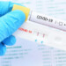 Positive test result by using rapid test device for COVID-19 virus, novel coronavirus 2019 found in Wuhan, China